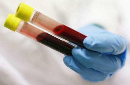 Загальний аналіз крові: розшифровка. Показники норми аналізу крові