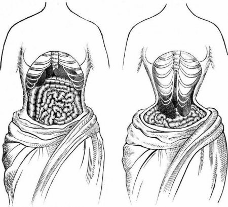   Waist Trainer:    