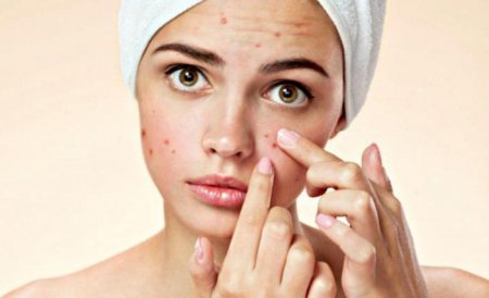    "" (La Roche Posay Effaclar): , 