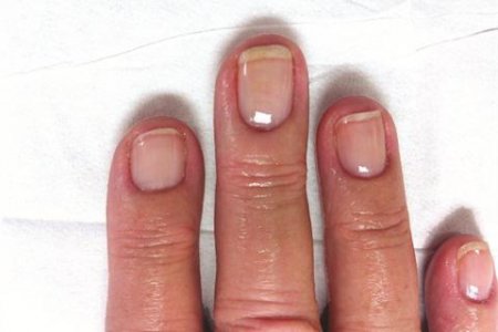 Ламінування нігтів: що це таке і для чого потрібно