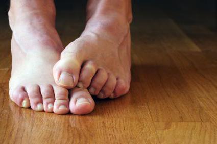 Чому сильно потіють і пахнуть ноги, що робити і як позбавитися від запаху