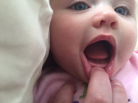 Дитині 9 місяців - немає зубів: що робити?